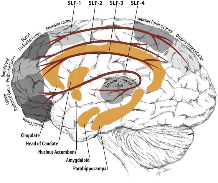 The brain anatomy of attention-deficit:hyperactivity disorder in young adults – a magnetic resonance imaging study